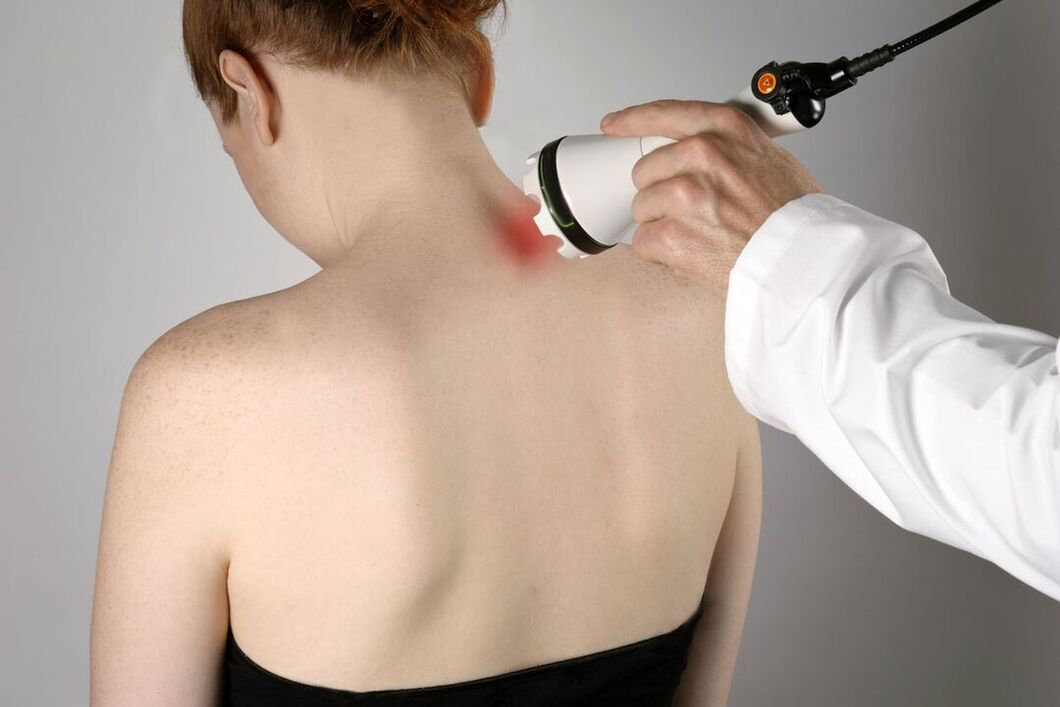 servikal osteokondrozun fizyoterapi tedavisi
