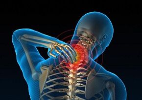 Neden gelişir ve servikal osteokondroz nasıl tezahür edilir